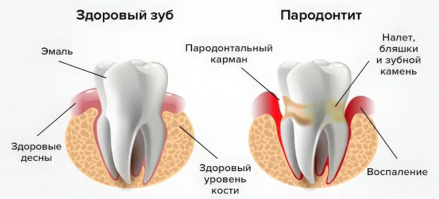 Как микроскоп помогает в диагностике и лечении заболеваний десен