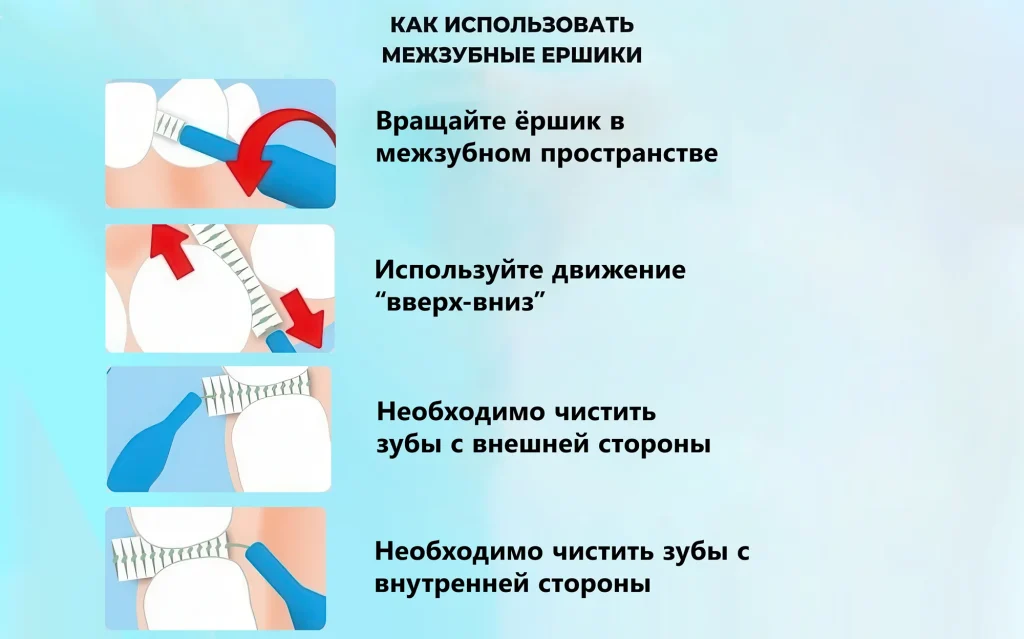 Как использовать межзубные ёршики