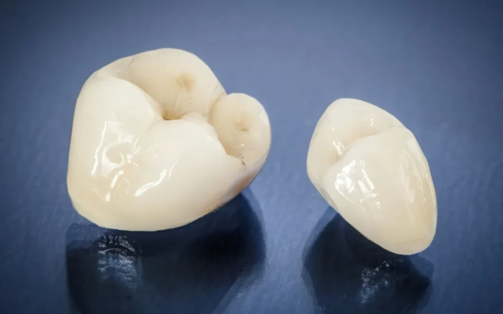 Временные коронки